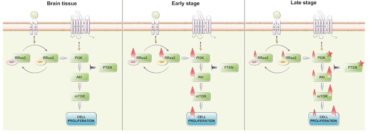Increased R-RAS2 expression in astrocytomas.jpg
